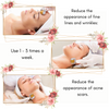 Derma Roller