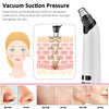 Pore Vacuum & Blackhead Remover